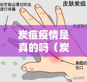 炭疽疫情是真的吗(炭疽疫情有什么症状百科) 炭疽疫情是真的吗(炭疽疫情有什么症状百科)