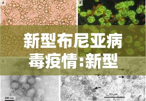 新型布尼亚病毒疫情:新型布尼亚病毒可以自愈吗感染治疗