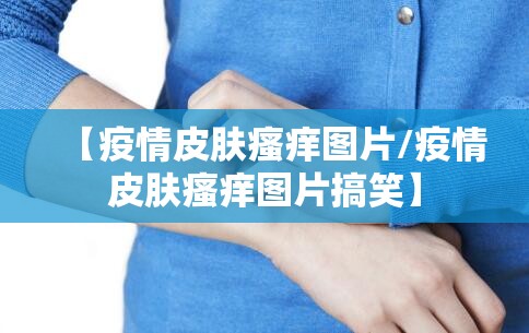 【疫情皮肤瘙痒图片/疫情皮肤瘙痒图片搞笑】 【疫情皮肤瘙痒图片/疫情皮肤瘙痒图片搞笑】