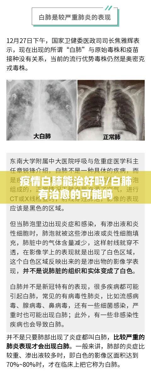疫情白肺能治好吗/白肺有治愈的可能吗 疫情白肺能治好吗/白肺有治愈的可能吗