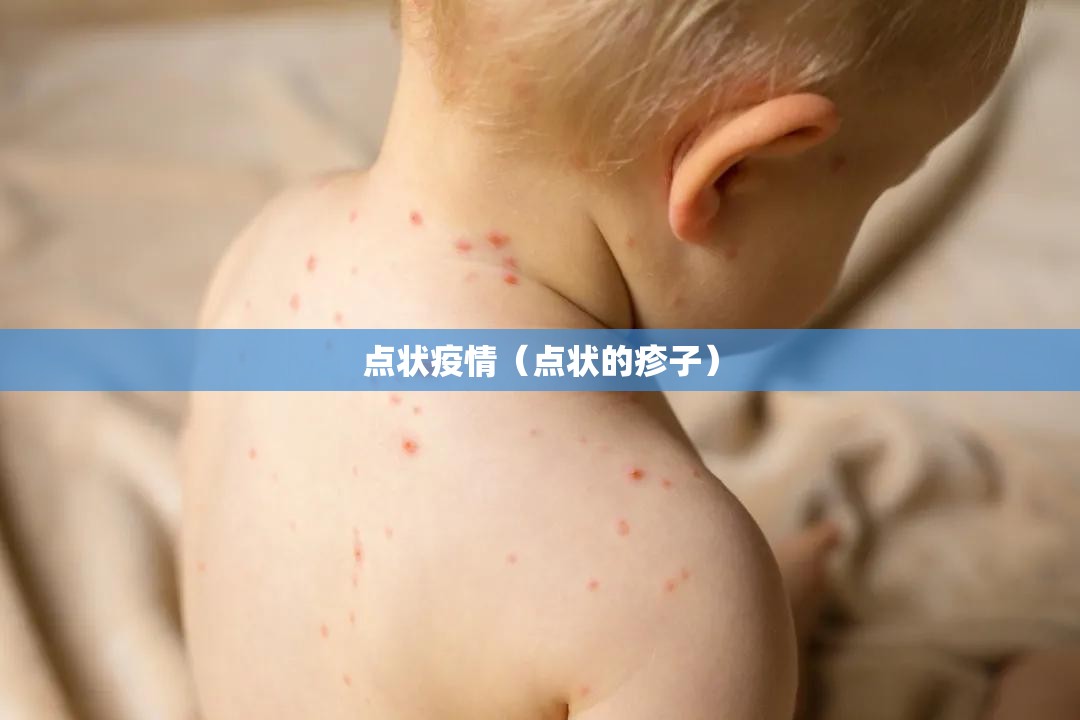 点状疫情（点状的疹子）