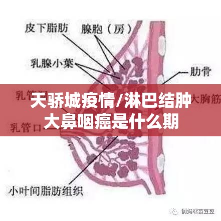 天骄城疫情/淋巴结肿大鼻咽癌是什么期