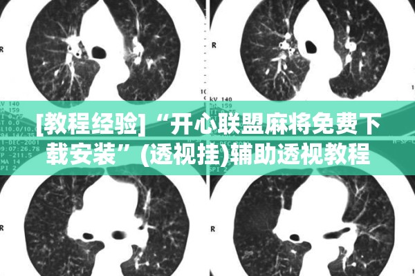 [教程经验]“开心联盟麻将免费下载安装”(透视挂)辅助透视教程