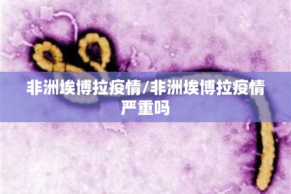 非洲埃博拉疫情/非洲埃博拉疫情严重吗 非洲埃博拉疫情/非洲埃博拉疫情严重吗