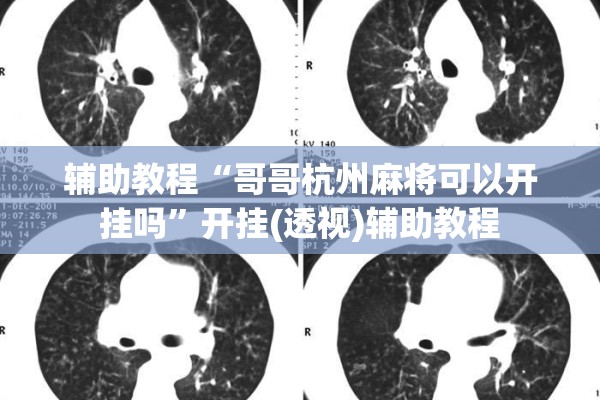 辅助教程“哥哥杭州麻将可以开挂吗	”开挂(透视)辅助教程