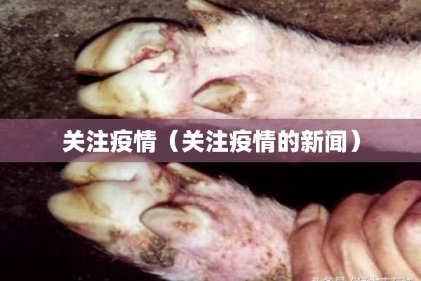 关注疫情（关注疫情的新闻）