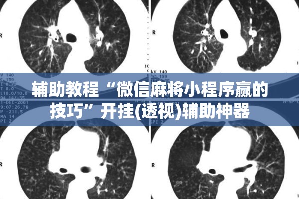 辅助教程“微信麻将小程序赢的技巧	”开挂(透视)辅助神器