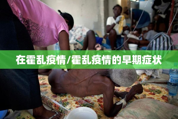 在霍乱疫情/霍乱疫情的早期症状 在霍乱疫情/霍乱疫情的早期症状