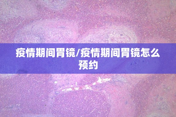 疫情期间胃镜/疫情期间胃镜怎么预约