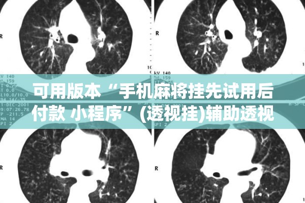 可用版本“手机麻将挂先试用后付款 小程序”(透视挂)辅助透视教程