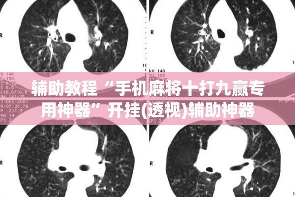 辅助教程“手机麻将十打九赢专用神器”开挂(透视)辅助神器