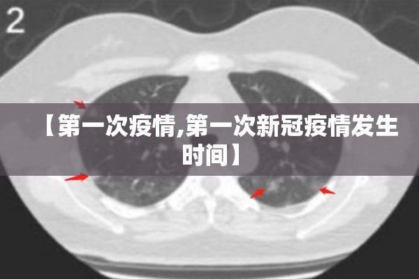 【第一次疫情,第一次新冠疫情发生时间】 【第一次疫情,第一次新冠疫情发生时间】