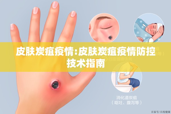 皮肤炭疽疫情:皮肤炭疽疫情防控技术指南