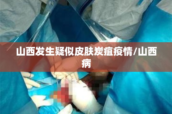 山西发生疑似皮肤炭疽疫情/山西病 山西发生疑似皮肤炭疽疫情/山西病