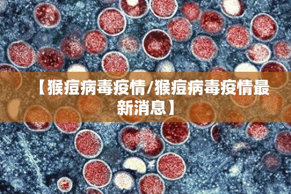 【猴痘病毒疫情/猴痘病毒疫情最新消息】 【猴痘病毒疫情/猴痘病毒疫情最新消息】