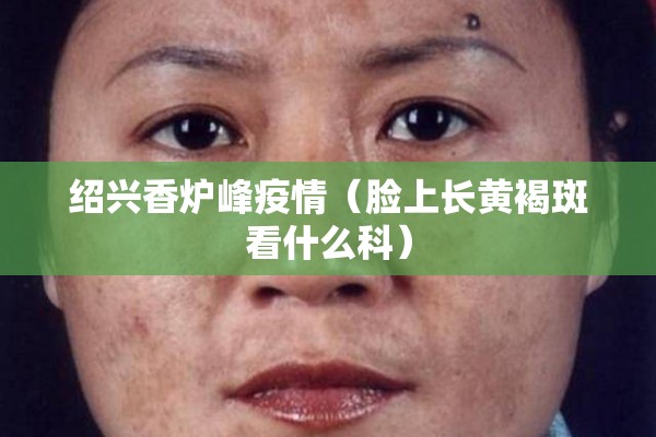 绍兴香炉峰疫情（脸上长黄褐斑看什么科）