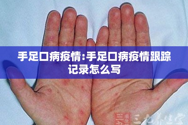 手足口病疫情:手足口病疫情跟踪记录怎么写