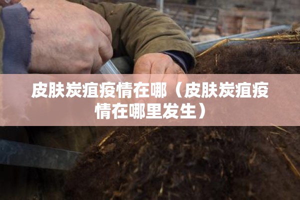 皮肤炭疽疫情在哪（皮肤炭疽疫情在哪里发生）