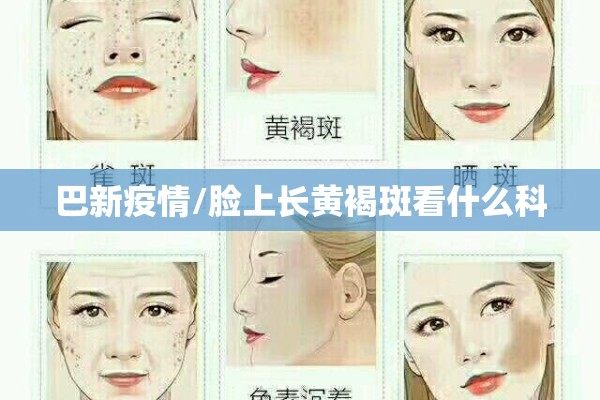 巴新疫情/脸上长黄褐斑看什么科
