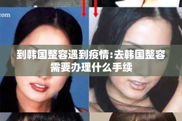 到韩国整容遇到疫情:去韩国整容需要办理什么手续