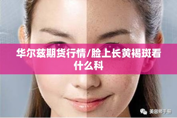 华尔兹期货行情/脸上长黄褐斑看什么科